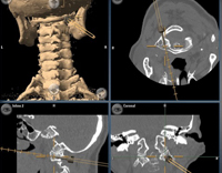 X-ray analysis for orthopaedic doctor